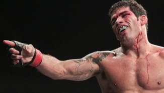 Assuncao си счупи глезена, остава извън играта поне два месеца