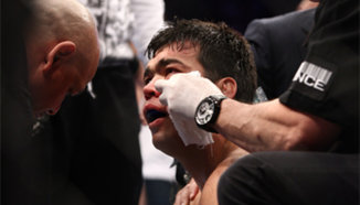 Lyoto Machida извън участие в двубои най-малко 60 дни