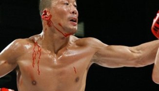 Състезател остана с половин ухо след MMA двубой