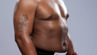Daniel Cormier е със счупена ръка